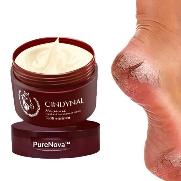PureNova™-Cindynal – La Crème Réparatrice Intense pour Mains & Pieds Sévèrement Abîmés
