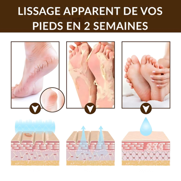 PureNova™-Cindynal – La Crème Réparatrice Intense pour Mains & Pieds Sévèrement Abîmés – Image 7