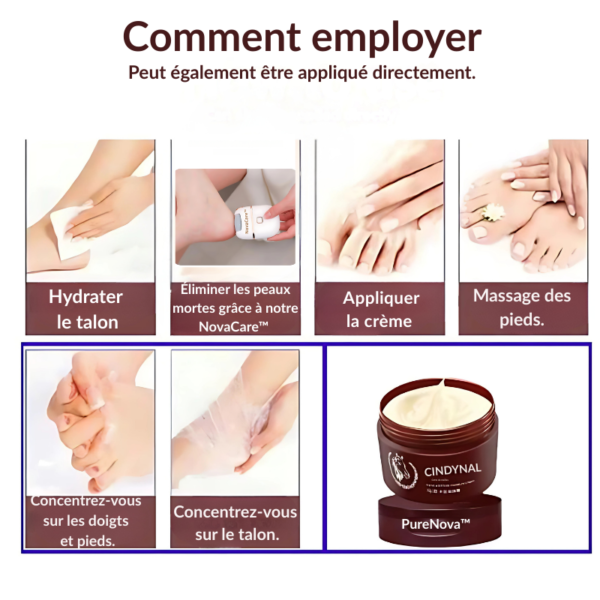 PureNova™-Cindynal – La Crème Réparatrice Intense pour Mains & Pieds Sévèrement Abîmés – Image 6