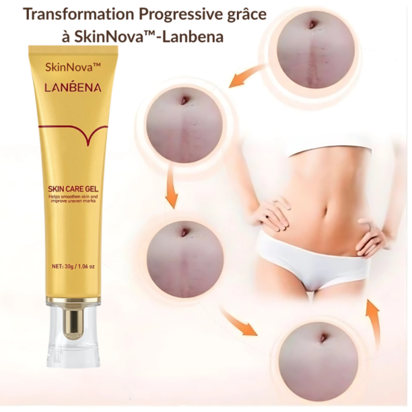 SkinNova™-Lanbena – Gel Réparateur pour Cicatrices, Vergetures et Marques d'Acné – Image 5