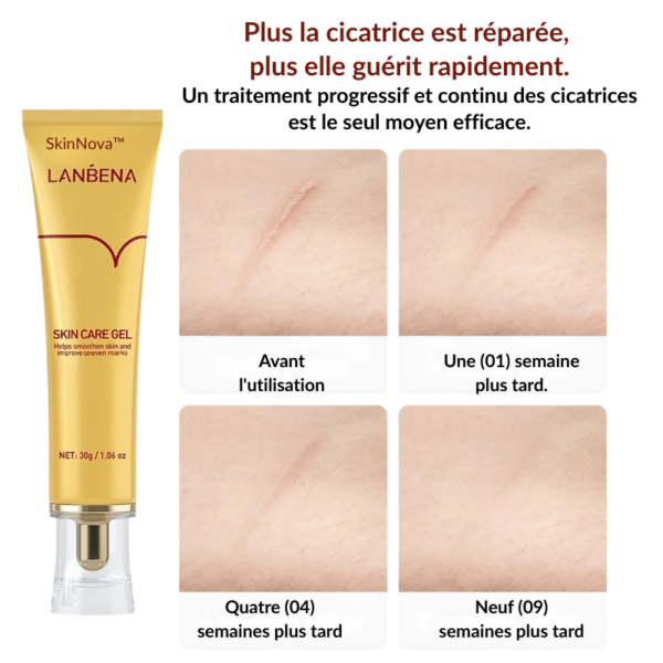 SkinNova™-Lanbena – Gel Réparateur pour Cicatrices, Vergetures et Marques d'Acné – Image 9